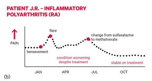 Patient - inflammatory polyarthritis graph.