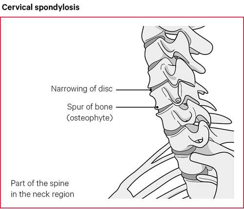 Pain in the Front of the Neck Symptom, Causes & Questions