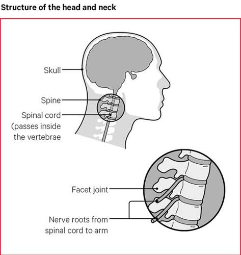 Easy tips to relieve stress-related neck and back pain, Back and Spine, Brain