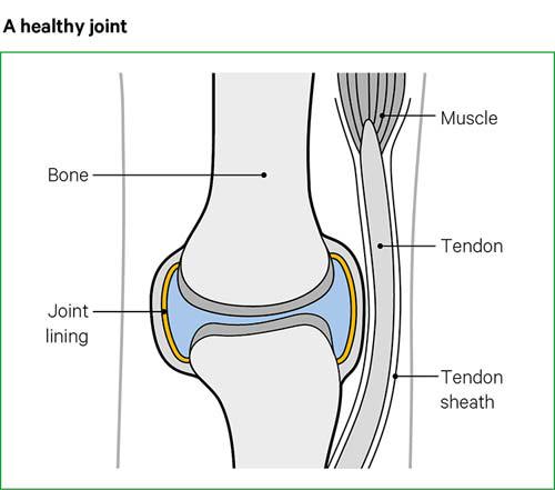 Stiff joints: Why they happen and how to get rid of them