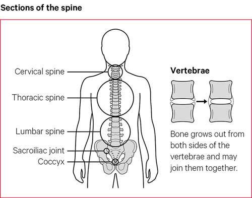 Why Lifting With A Straighter Spine Doesn't Reduce Your Risk Of Back Pain –  The Sports Physio