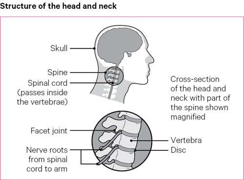 Structure of the head and neck comprises of the skull, spinal cord, facet joints and nerve roots.