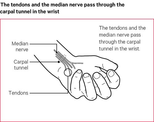 Numbness in hand and arm 2025 left side