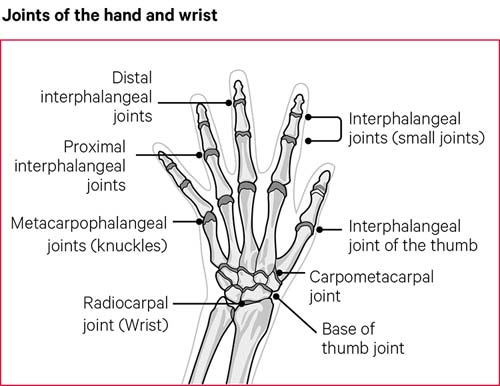 Ortho Dx: A painful ring finger - Clinical Advisor