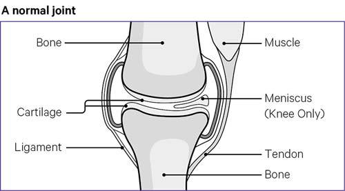 A healthy knee joint with no damage to the bone, cartilage or meniscus.