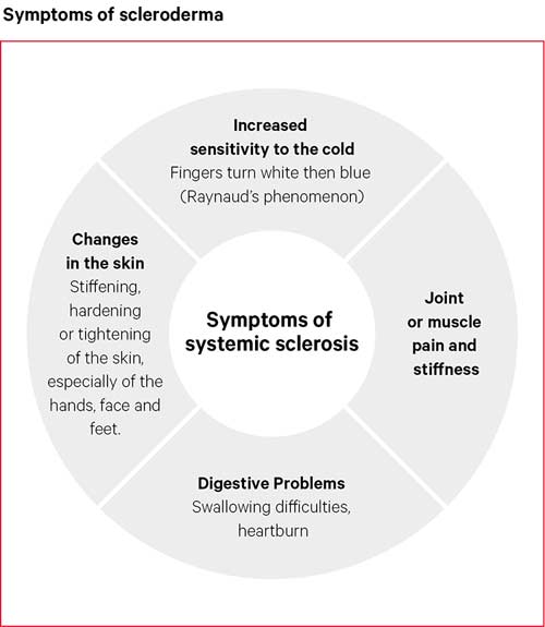 What is one clinical manifestation 2025 of scleroderma
