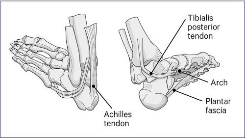 Plantar Fasciitis  Causes, symptoms, treatments